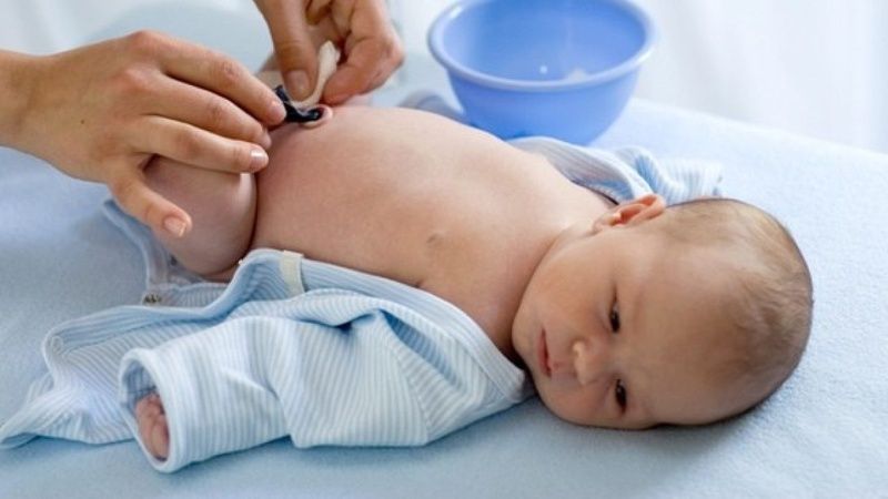 Rốn trẻ sơ sinh bị chảy máu: nguyên nhân và cách chăm sóc