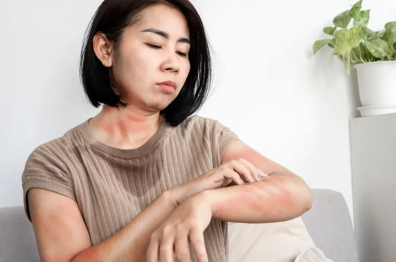 Kháng sinh nhóm macrolid: cơ chế tác động và loại thuốc phổ biến