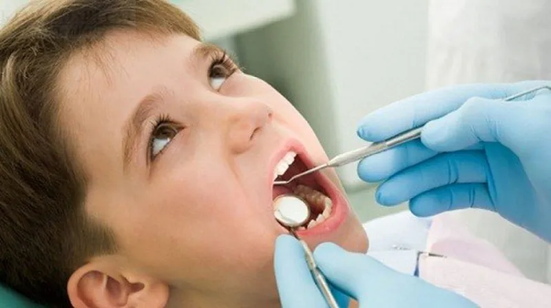 Vấn đề của răng sữa và cách khắc phục hiệu quả khi trẻ bị gãy răng sữa