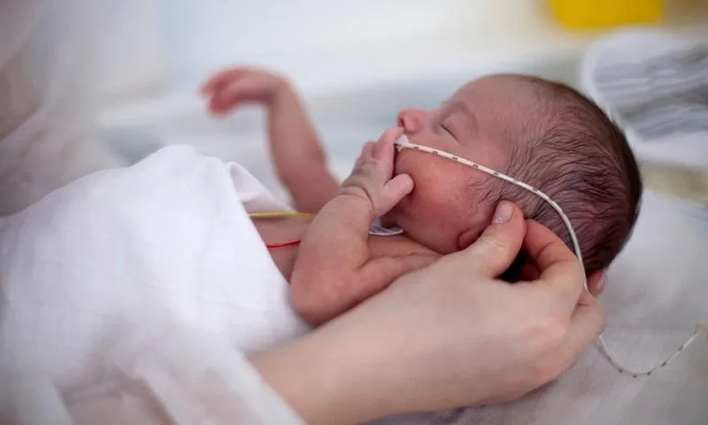 Trẻ sinh non: cách xử lý và phòng ngừa