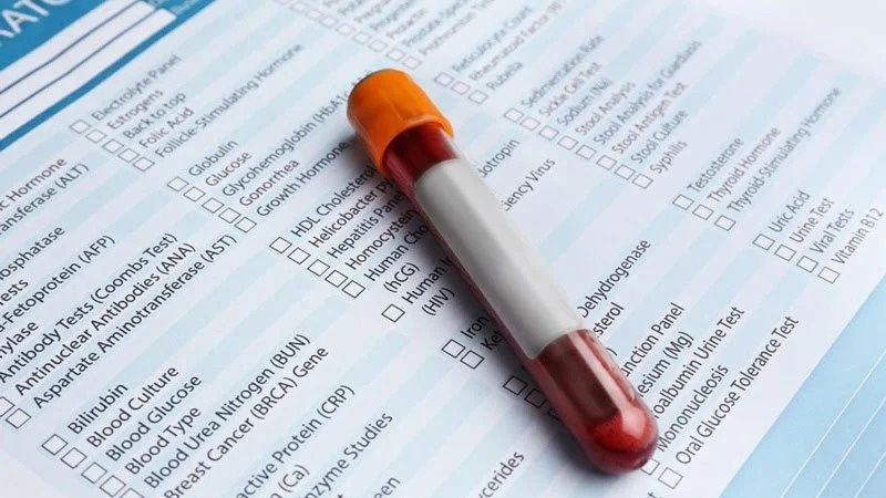 Xét nghiệm anti ds dna và vai trò của nó trong chẩn đoán lupus ban đỏ hệ thống