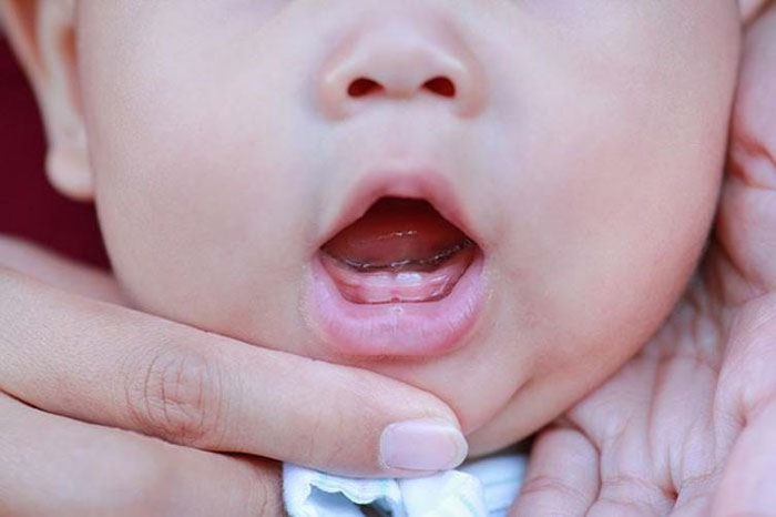 Thứ tự mọc răng sữa và các thông tin quan trọng