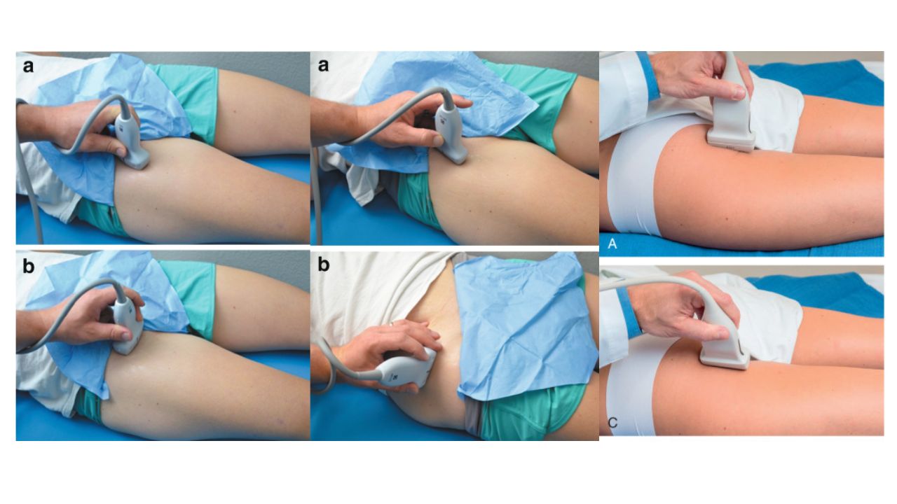 Siêu âm khớp háng: Quy trình, vai trò và lợi ích trong chẩn đoán bệnh
