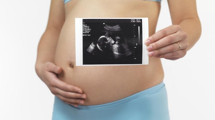 7 biện pháp chẩn đoán trước sinh phát hiện di tật thai nhi - BIOMEDIC JSC -  Reliable value