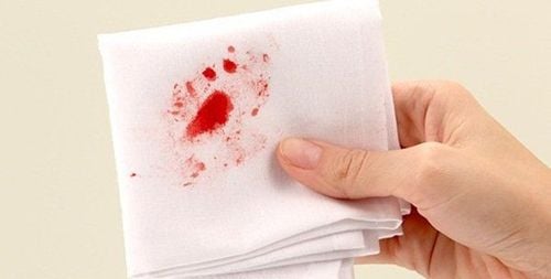 Trẻ đi ngoài ra máu khi nào nguy hiểm? | Vinmec