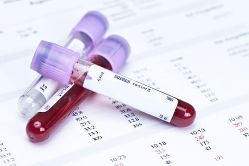 Chỉ số MCV: 78,3 fl và MCH: 25,7 pg trong xét nghiệm máu có ý nghĩa gì? |  Vinmec