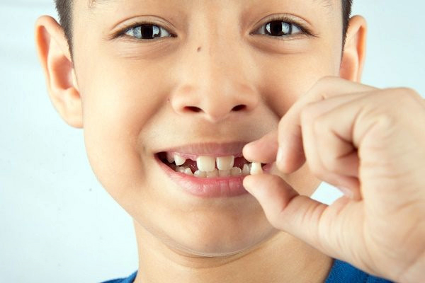 Quy trình thay răng ở trẻ em như thế nào? - Nha Khoa LINH XUÂN