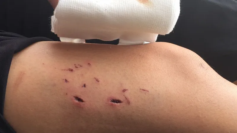 Chó không bị dại cắn có sao không? tìm hiểu ngay để bảo vệ thú cưng của bạn