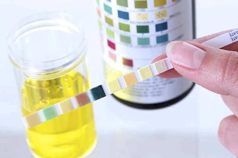 Hình minh họa màu sắc của nước tiểu có thể phản ánh tình trạng hydrat hóa của cơ thể.
