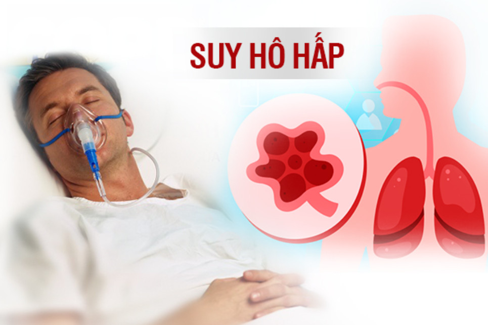 Biến chứng nguy hiểm từ suy hô hấp gây ảnh hưởng đến tim, phổi, hệ thần kinh.