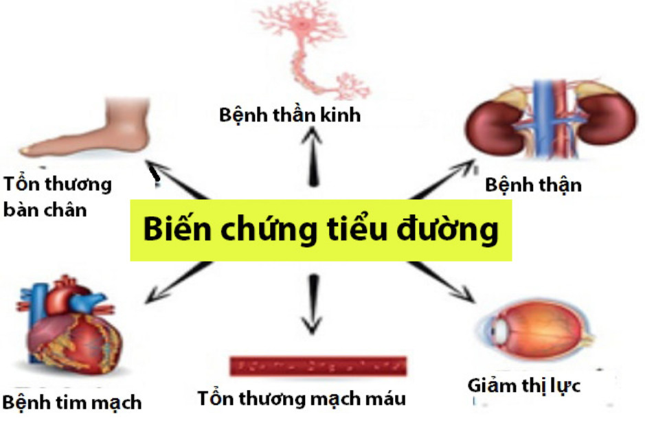 Các biến chứng của bệnh đái tháo đường 