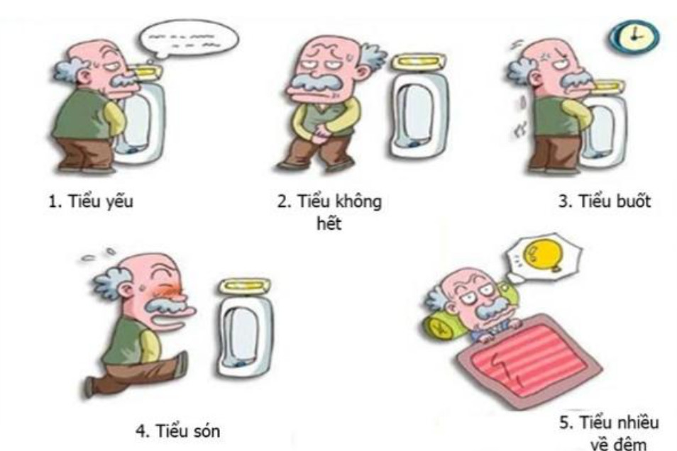 Một số triệu chứng của phì đại tuyến tiền liệt