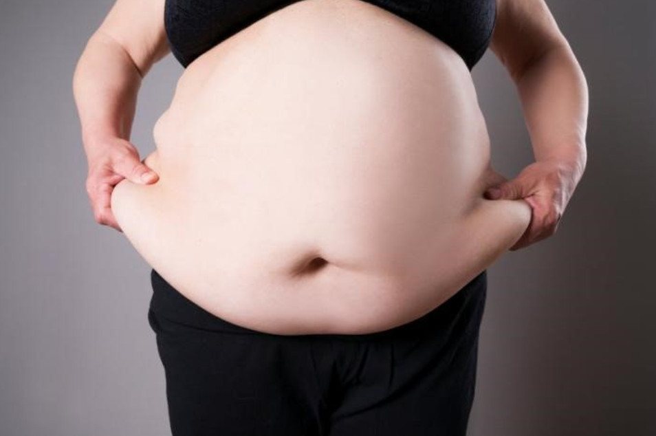 Béo phì có thể gây ra tình trạng ngủ ngáy nhiều