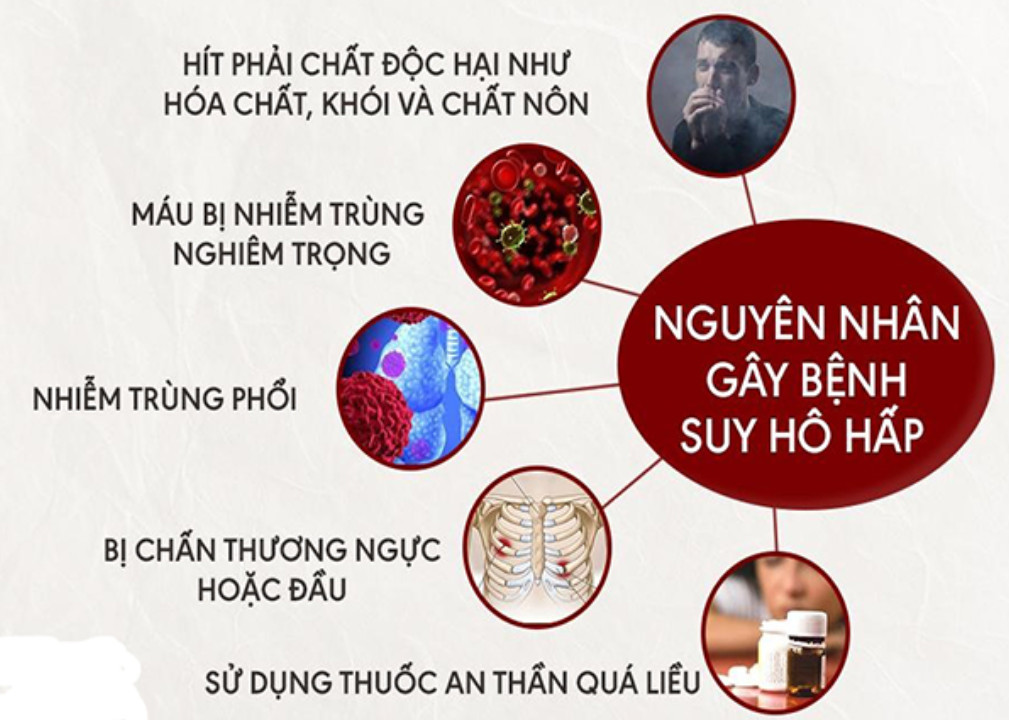 Các nguyên nhân gây bệnh suy hô hấp