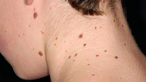 Thăm khám tình trạng da ngay khi xuất hiện những dấu hiệu bất thường