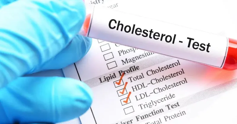 Hình minh họa mức cholesterol 