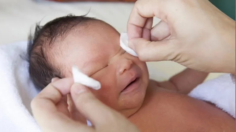 Thuốc nhỏ mắt chữa tắc tuyến lệ ở trẻ em: hiệu quả và những thông tin cần biết