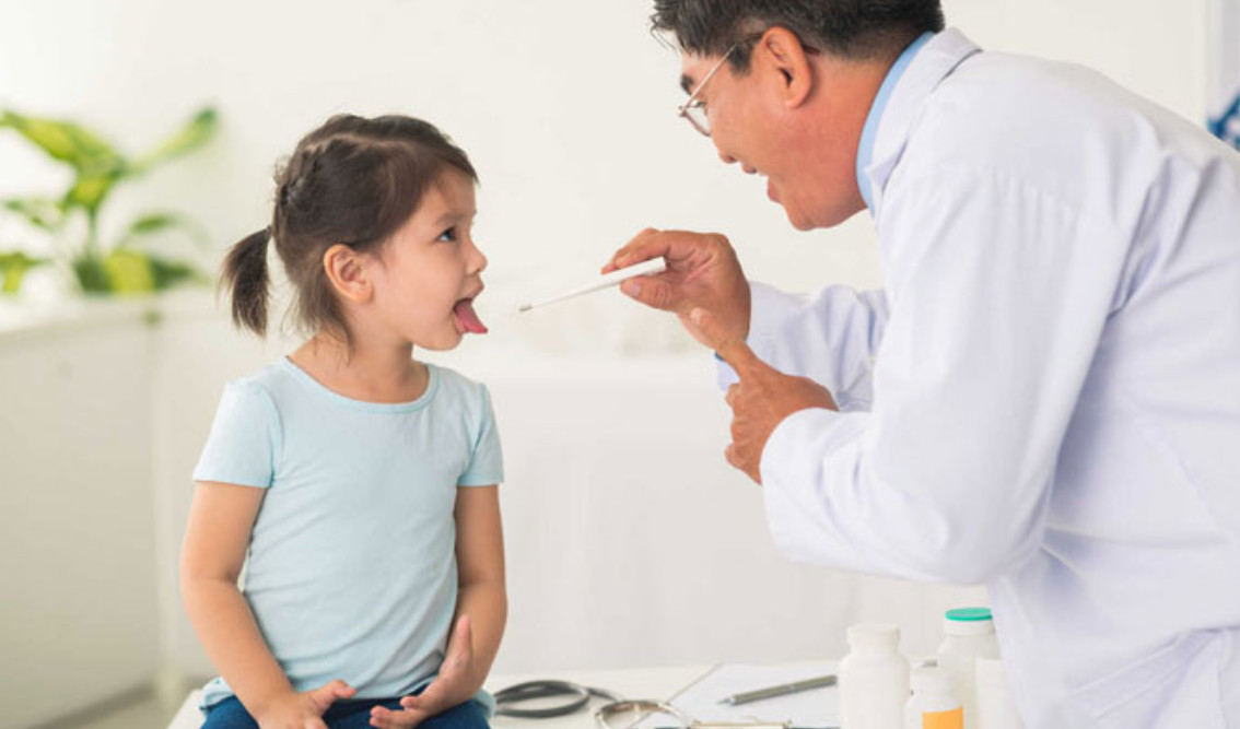 Chẩn đoán bệnh viêm amidan