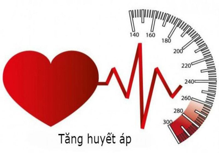 Tăng huyết áp có thể là nguyên nhân gây ra rung nhĩ