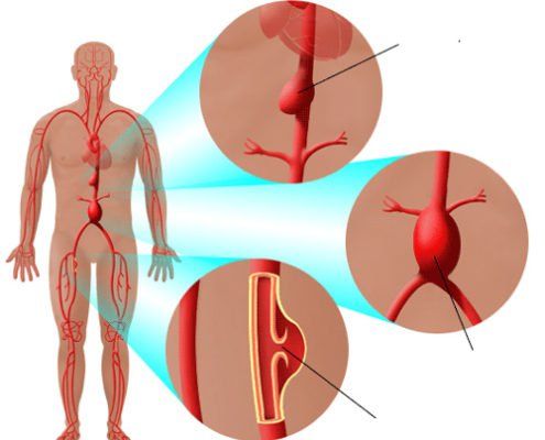 Hệ thống động mạch vận chuyển máu từ tim đến các cơ quan trong cơ thể
