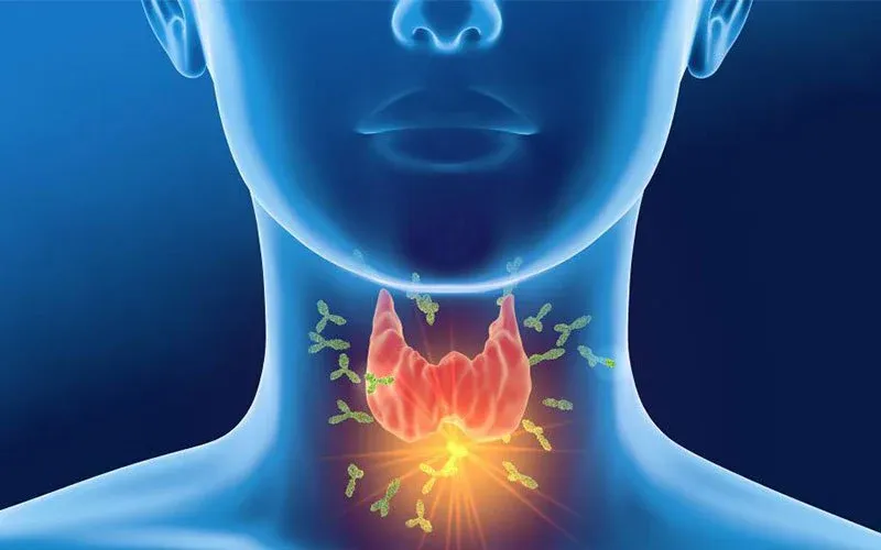 Suy tuyến cận giáp hiểm họa thầm lặng đối với sức khỏe
