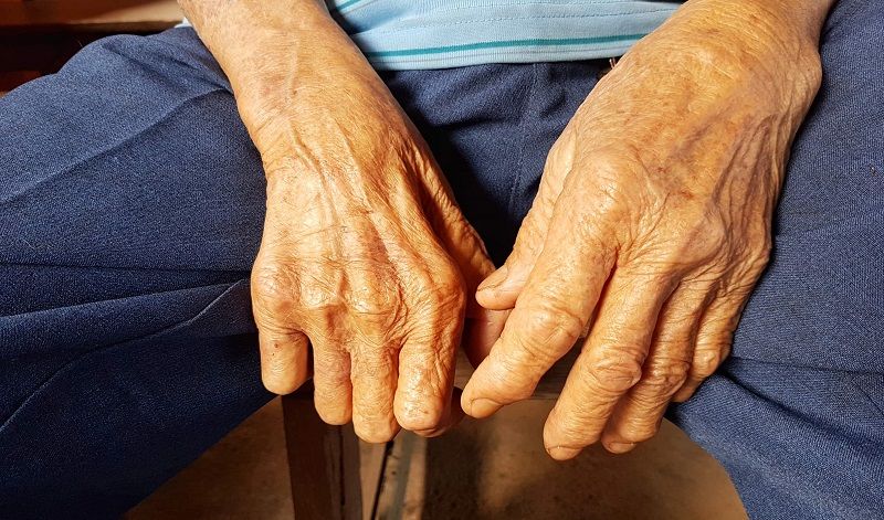 Hiểu biết đúng về bệnh phong giúp giảm bớt lo âu và kỳ thị trong cộng đồng 
