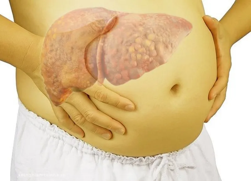 Các triệu chứng ở giai đoạn 4 thường gây suy kiệt nhanh chóng sức khỏe người bệnh 
