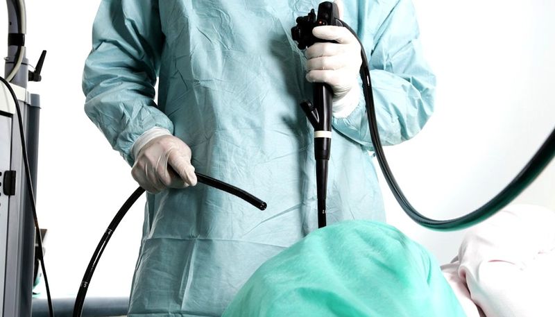 Hình minh họa trình tự nội soi