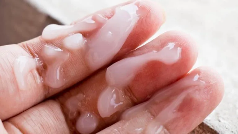 Màu sắc tinh dịch và vai trò của nó trong sức khỏe sinh sản nam