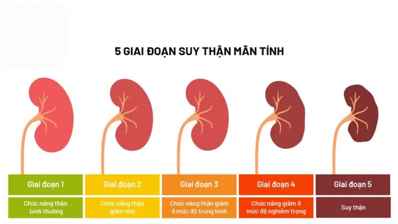 Khám cận lâm sàng là bước không thể thiếu để xác định chính xác tình trạng chức năng thận