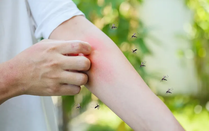 Bệnh sốt xuất huyết ở người lớn: triệu chứng, biến chứng và cách điều trị hiệu quả