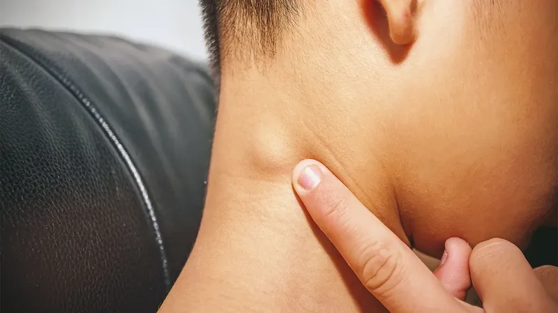 Hình minh họa tuyến giáp và eo tuyến giáp