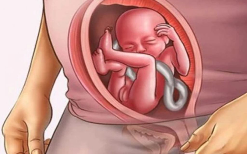 Hình minh họa mục tiêu cuối cùng của mọi phương thức sinh là em bé ra đời khỏe mạnh