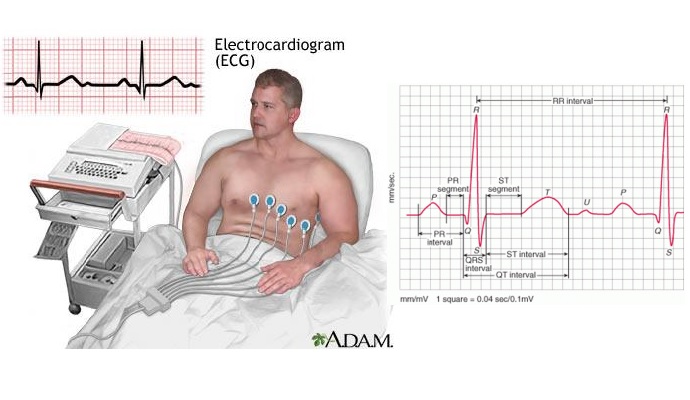 Sử dụng ECG theo dõi