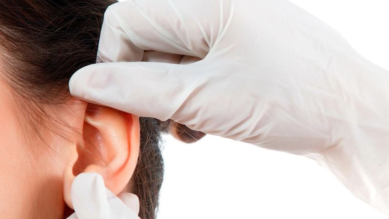 Nội soi tai là phương pháp cần thiết để xác định giai đoạn tiến triển của bệnh 
