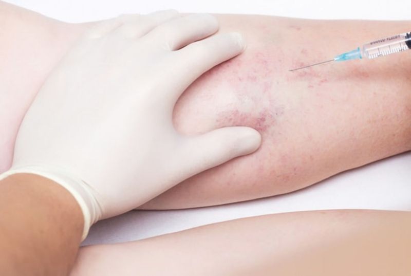 Kỹ thuật viên tiến hành rút máu tĩnh mạch và đưa vào hệ thống ly tâm để phân tích định lượng chỉ số NSE