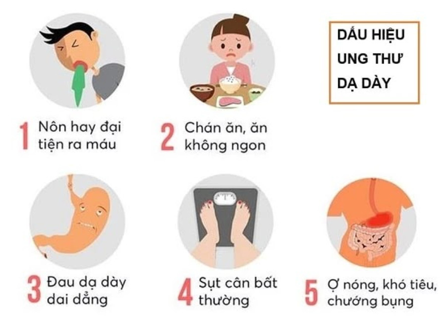 Triệu chứng của ung thư dạ dày