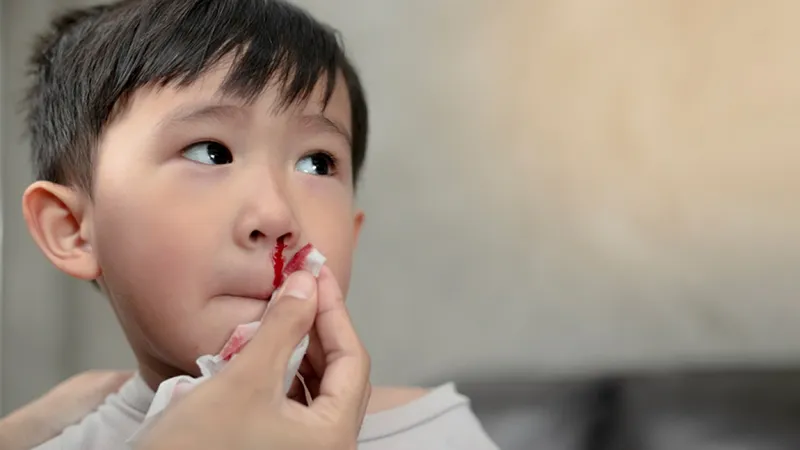 Hình ảnh minh họa mũi với nhiều mạch máu nhỏ dễ bị tổn thương gây chảy máu cam ở trẻ