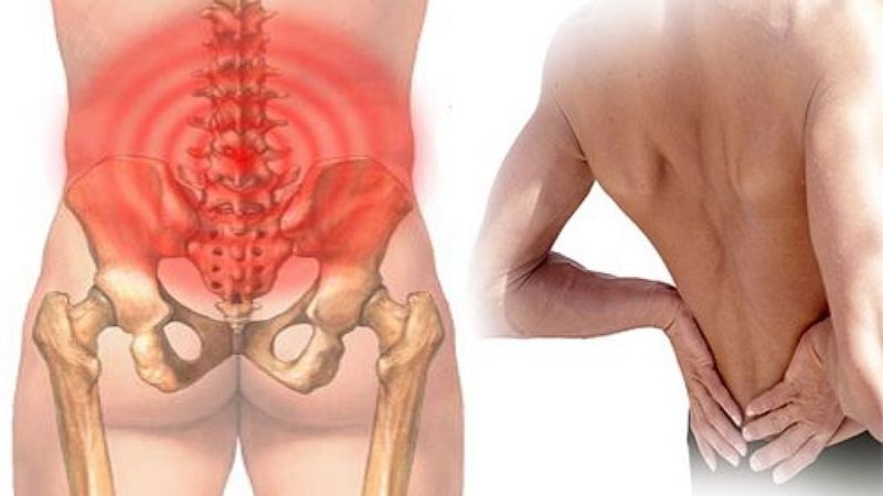Ung thư xương vùng lưng gây đau âm ỉ và dễ bị nhầm lẫn