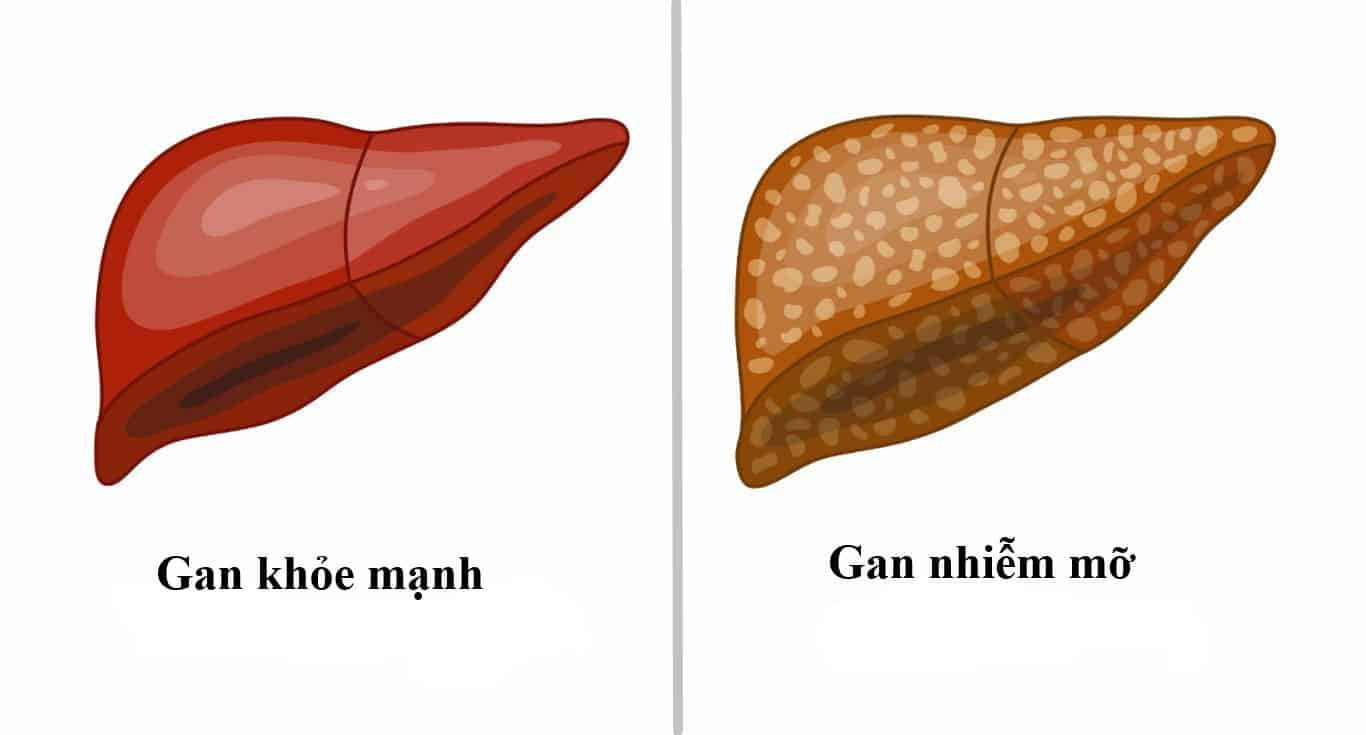 Gan không chỉ là một cơ quan, mà còn là một nhà máy hóa chất