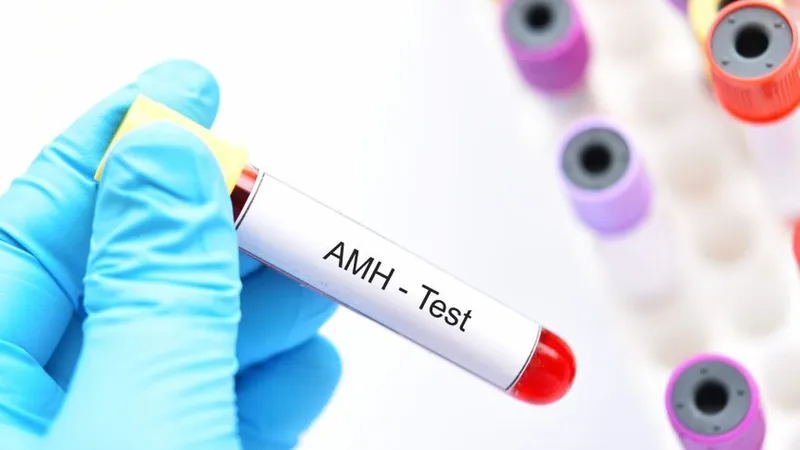 Xét nghiệm AMH