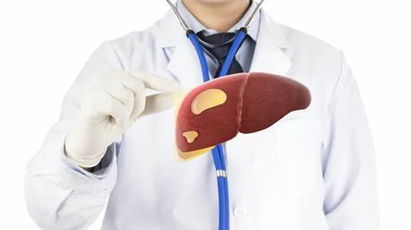 Phát hiện sớm gan nhiễm mỡ độ 1 giúp ngăn chặn biến chứng rạng rỡ và bền bỉ 
