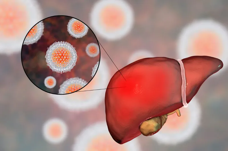 Máu là con đường lây truyền chính và nguy hiểm nhất của virus viêm gan C 