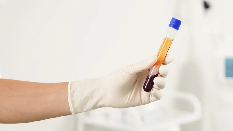 Xét nghiệm công thức máu giúp đánh giá nhiều chỉ số quan trọng của cơ thể