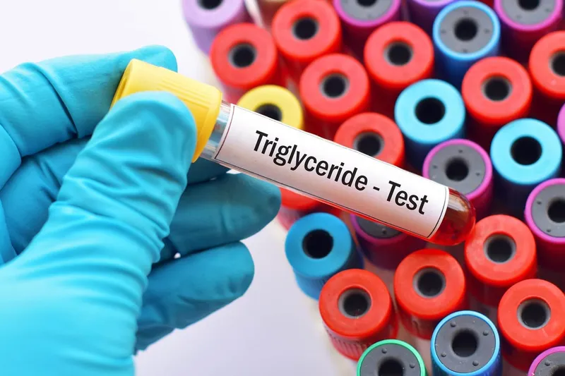 Hình minh họa xét nghiệm Triglyceride