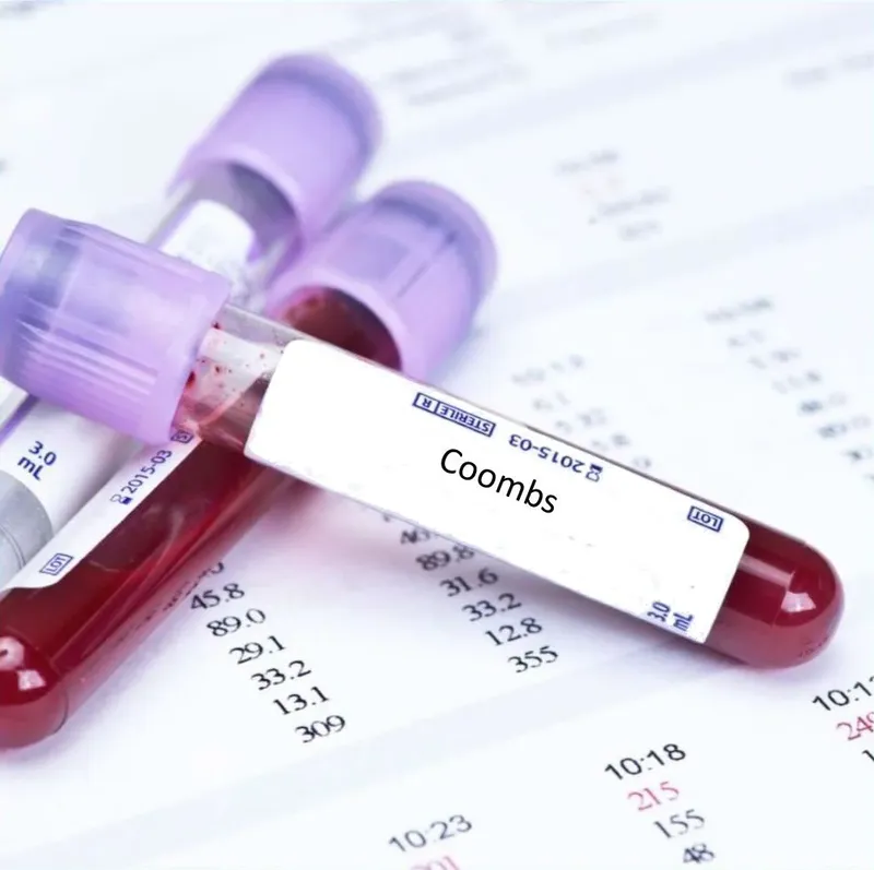 Coombs test (nghiệm pháp coombs): một công cụ quan trọng trong chẩn ...