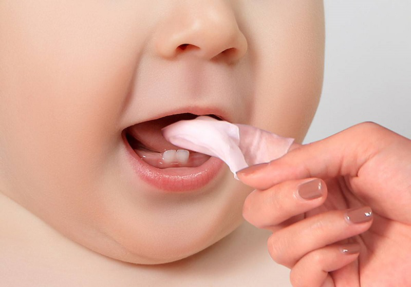 Lớp rêu trắng trên lưỡi có thể xuất hiện ở người mắc trào ngược dạ dày thực quản