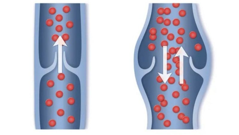 Tĩnh mạch có cấu tạo gồm nhiều lớp và hệ thống van một chiều