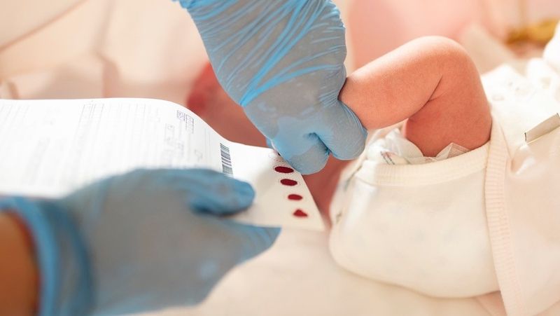 Hình minh họa lấy máu gót chân làm xét nghiệm