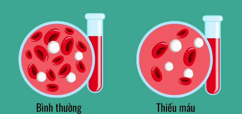 Hình minh họa xét nghiệm máu hiện đại